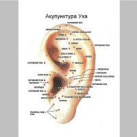 Плакат рефлексогенных точек уха
