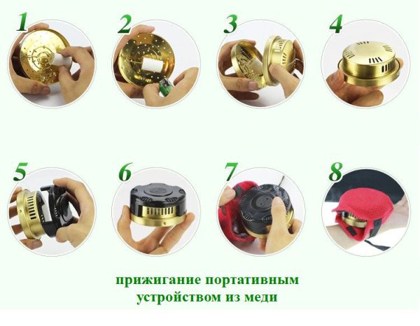 prizhiganie-mednaya-kor-2