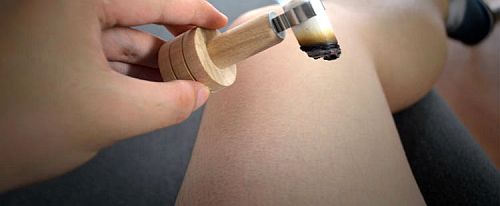 dergatel-derev7 dergatel-derev7